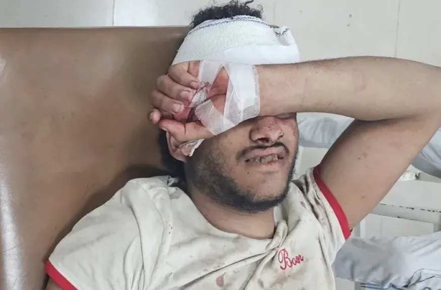 قناص حوثي يصطاد شابًا في تعز